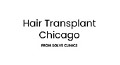 Hair Transplant Chicago